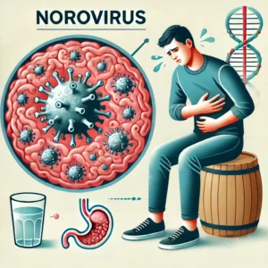 ¿Qué es el Norovirus?